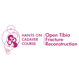 OPEN TIBIA FRACTURE RECONSTRUCTION | ΠΓΝ ΑΤΤΙΚΟΝ ΟΚΕΕ Π.Ν. ΣΟΥΚΑΚΟΣ | ΚΑΤ  01/06/22-04/06/22