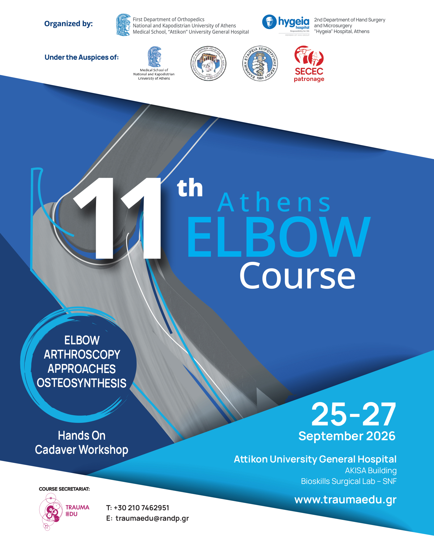 elbow 11